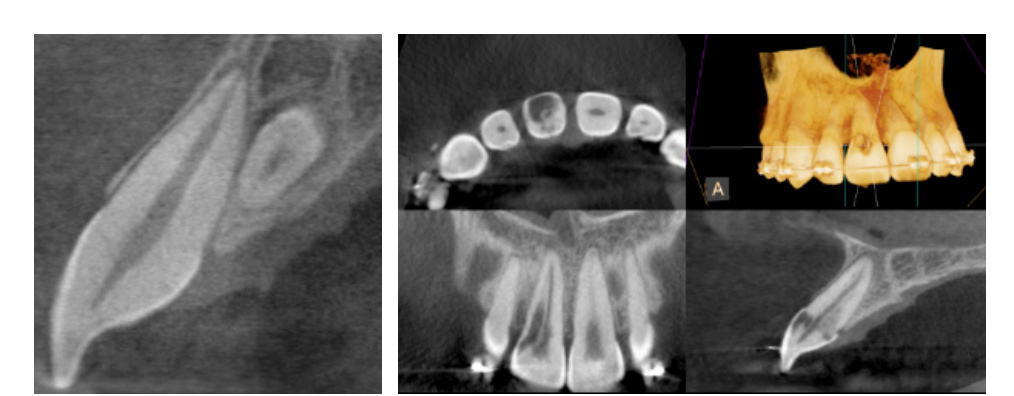 CBCT Technology in Abilene