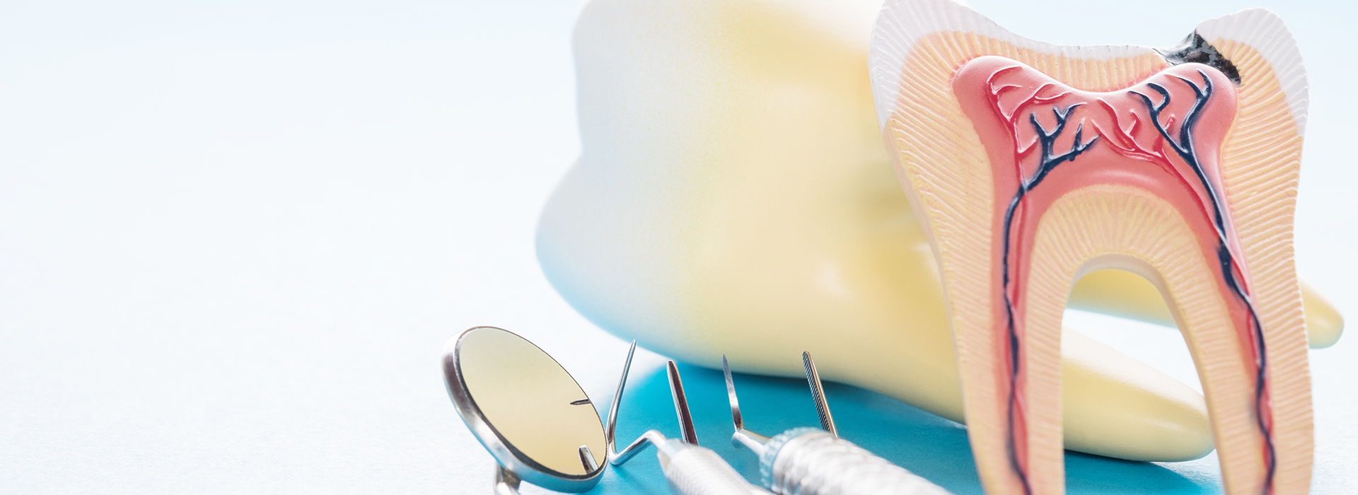 Root Canal Treatment in Abilene